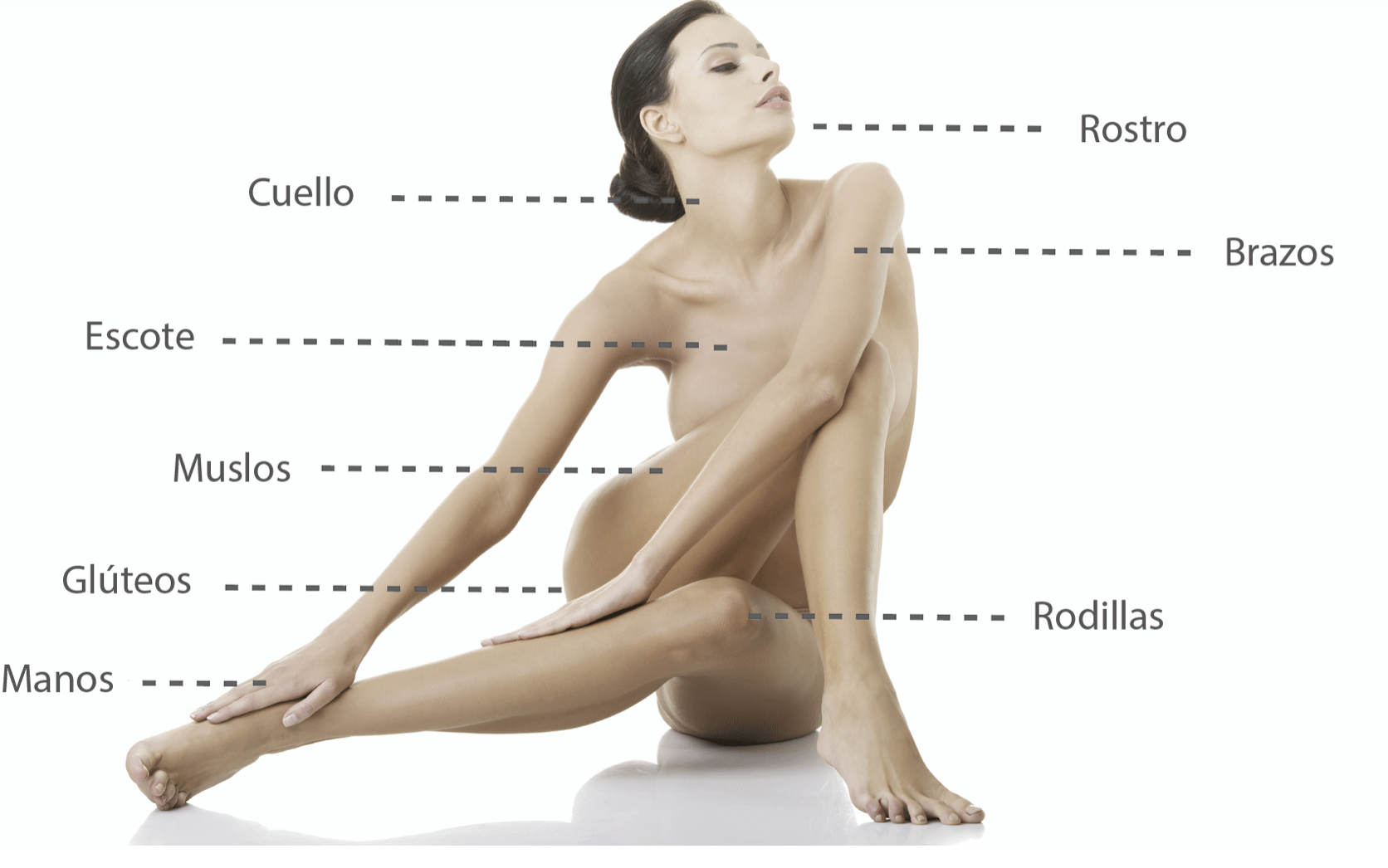 Áreas de aplicación de Sculptra en el cuerpo